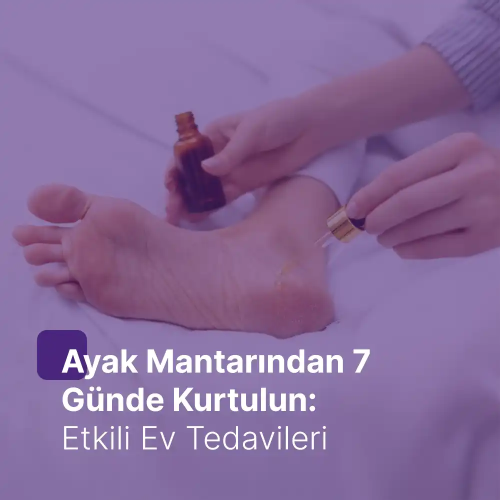 Ayak Mantarından 7 Günde Kurtulun: Etkili Ev Tedavileri
