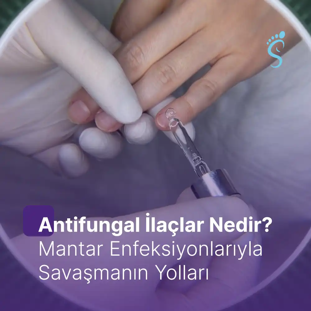 Antifungal İlaçlar Nedir? Mantar Enfeksiyonlarıyla Savaşmanın Yolları